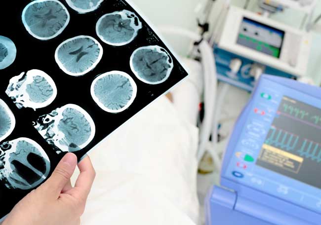 Curso de Urgencias Neurológicas – 7 de septiembre