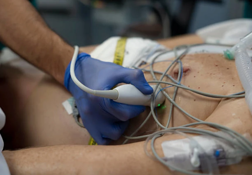 🌐🩻 Curso Presencial de Ecografía POCUS: Formación Intensiva con Certificación Internacional l Viernes 13 y Sábado 14 de marzo de 2026