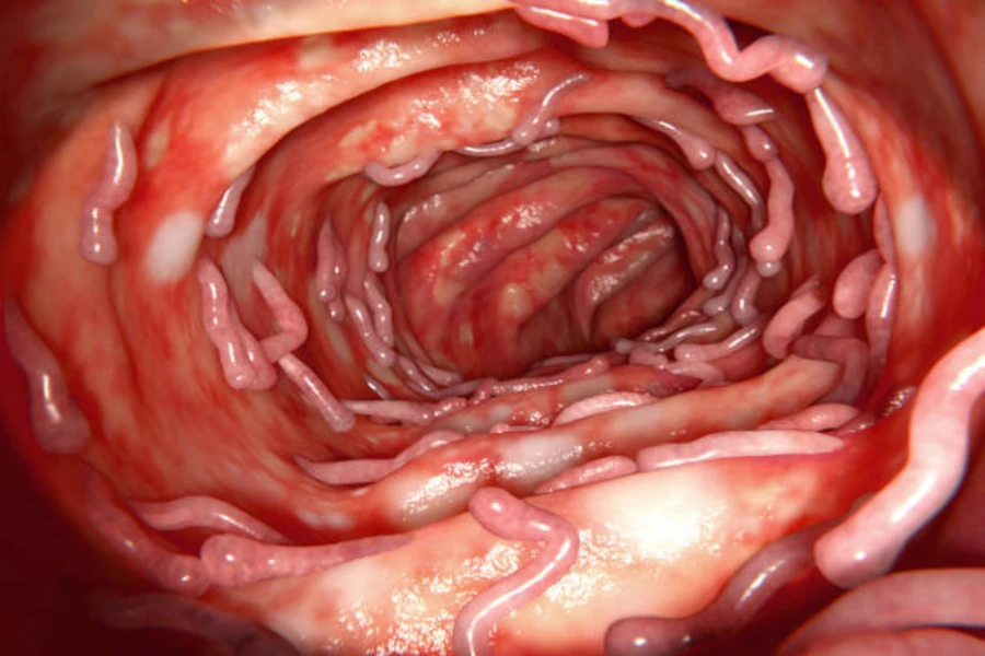 🩺 Jornada Científica: Colitis Ulcerosa Grave. Actualización y casos clínicos para la práctica médica | jueves 8 de octubre 